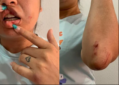 Marcas das agressões