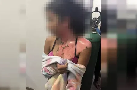 Vítima foi queimada com água quente pela tia no DF